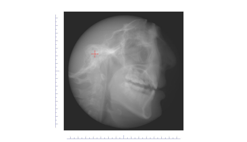 CephaloMetrics AtoZ Ver.16.5