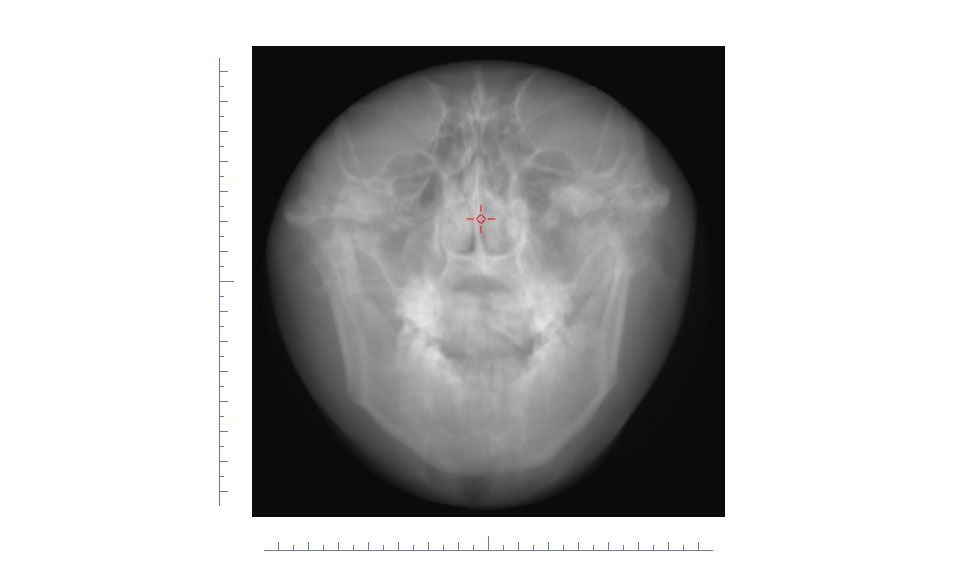 CephaloMetrics AtoZ Ver.16.5