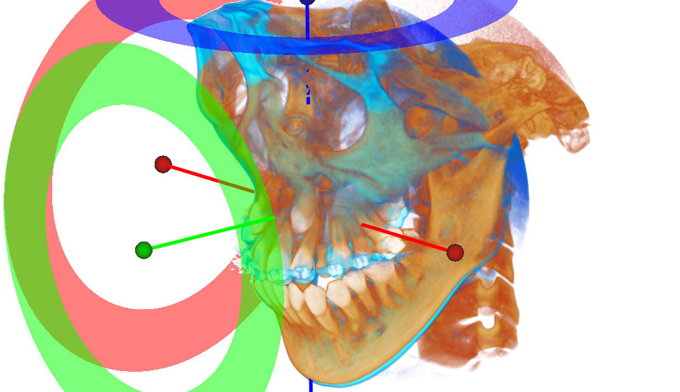 CephaloMetrics AtoZ Ver.16.5