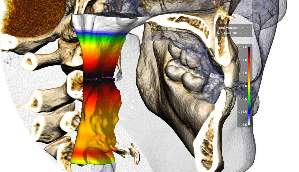 CephaloMetrics AtoZ Ver.16.5