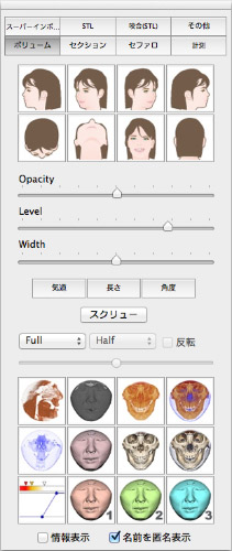 ボリュームレンダリング