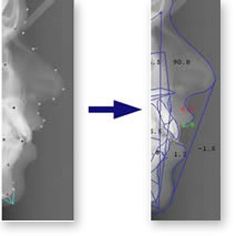 How to input a lateral line