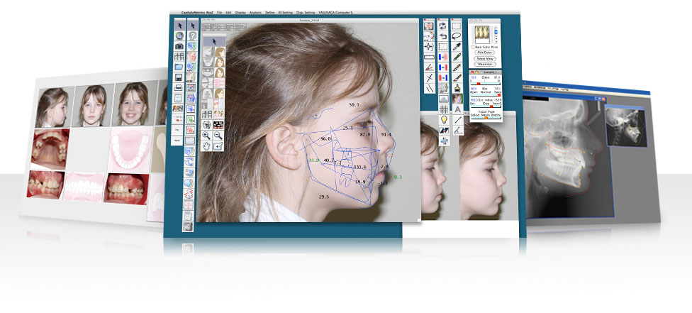 CephaloMetrics AtoZ
