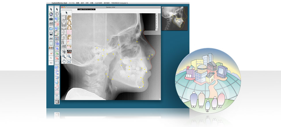 CephaloMetrics AtoZ　Characteristics