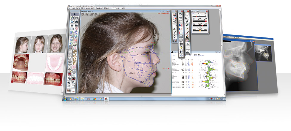 CephaloMetrics AtoZ