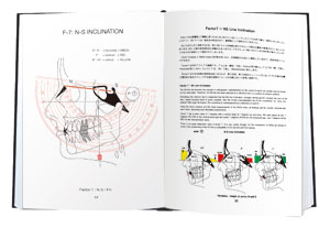 THE BIMLER CEPHALOMETRIC ANALYSIS