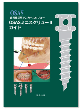 OSASミニスクリューIIガイド