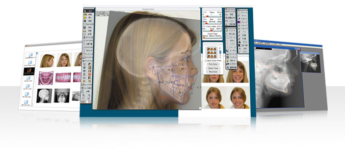 CephaloMetrics AtoZ