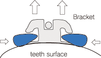 Bracket Remover #633