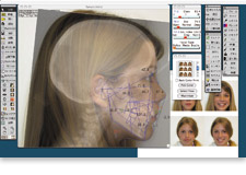 CephaloMetrics AtoZ