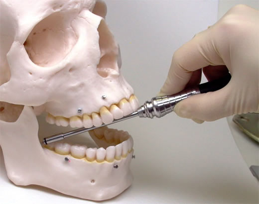 OSAS Driver Tip, 70mm