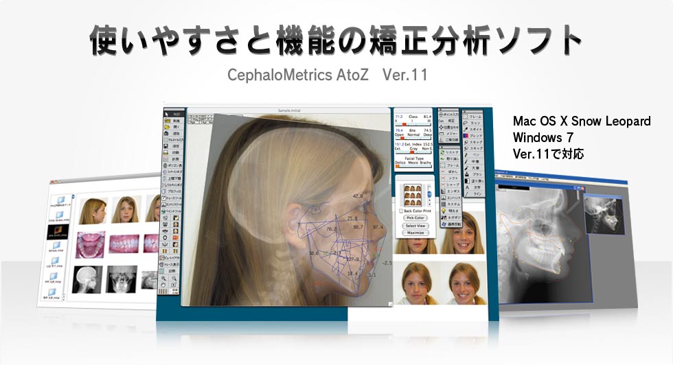 CephaloMetrics AtoZ Ver.11