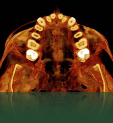 Endodontics