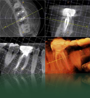 Endodontics