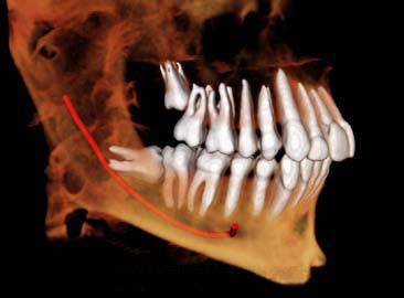 3d modeling asymmetry