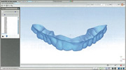 Clear Aligners