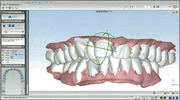 　Clear Aligners